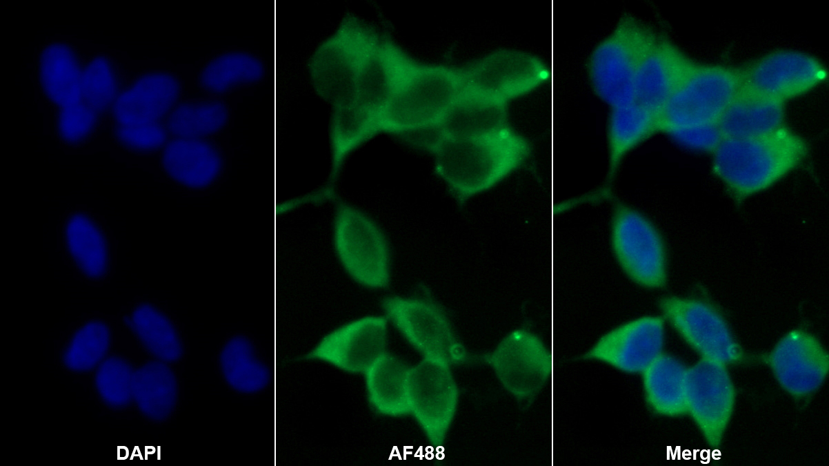 張力蛋白1(TNS1)多克隆抗體