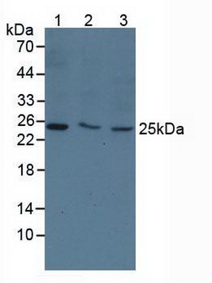 可溶性胸苷激酶1(TK1)多克隆抗体