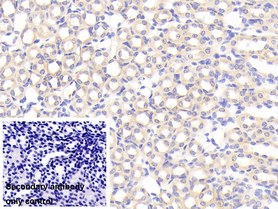 Sideroflexin 1蛋白(SFXN1)多克隆抗體