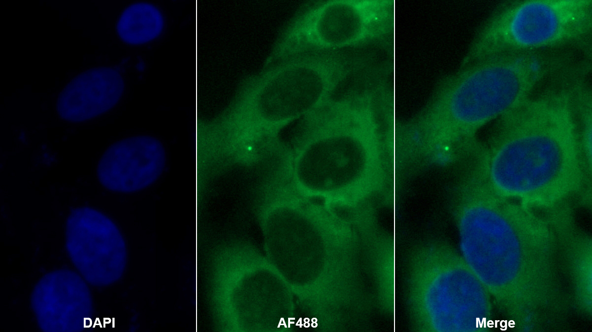 精胺合酶(SMS)多克隆抗体