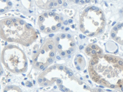 信号转导衔接分子2(STAM2)多克隆抗体