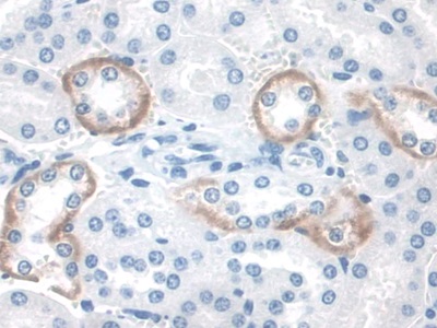 信号转导衔接分子2(STAM2)多克隆抗体