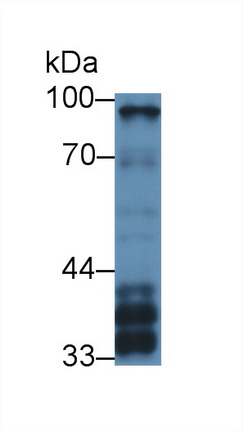 基質(zhì)相互作用分子1(STIM1)多克隆抗體