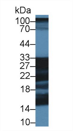 25kDa突觸關(guān)聯(lián)蛋白(SNAP25)多克隆抗體