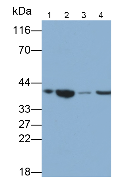 癌胚抗原相關細胞粘附分子8(CEACAM8)多克隆抗體