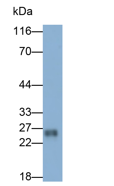 血漿谷胱甘肽過氧化物酶(GPX3)多克隆抗體