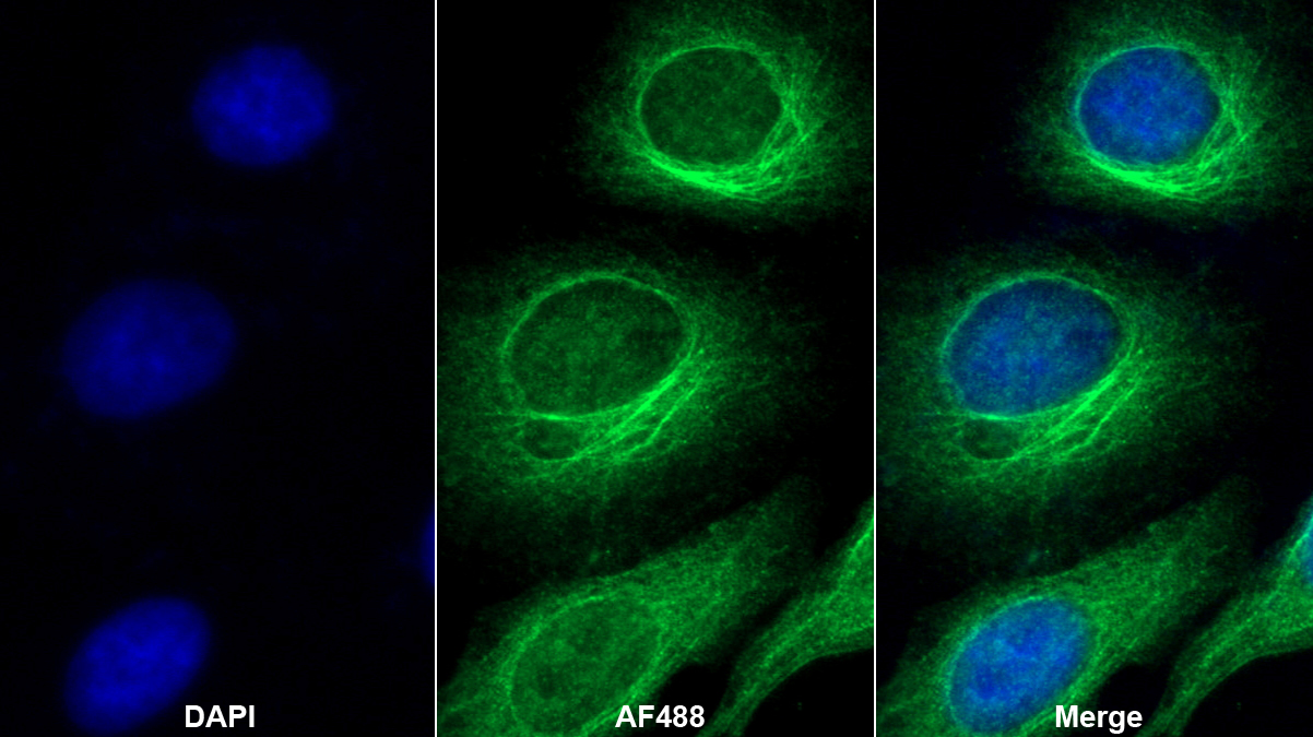 谷胱甘肽过氧化酶4(GPX4)多克隆抗体