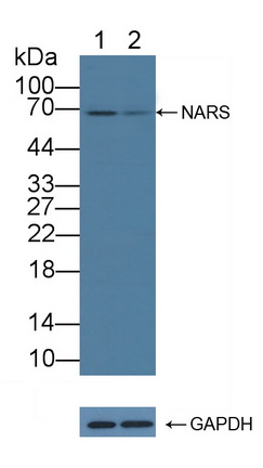 天冬酰tRNA合成酶(NARS)多克隆抗体