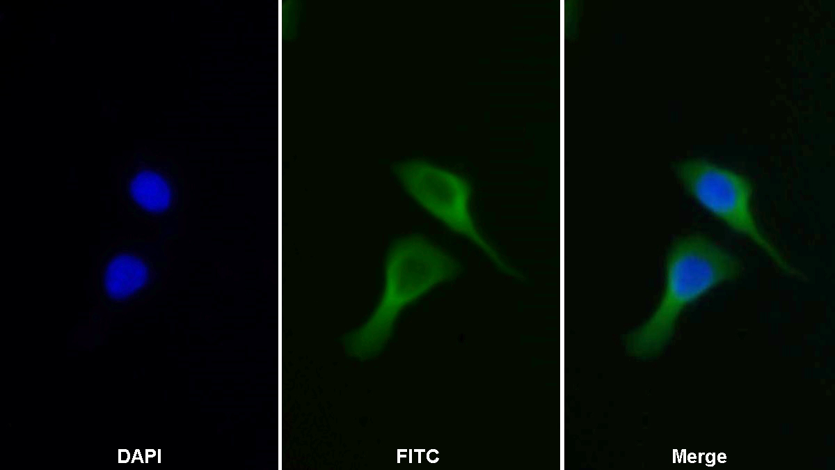 苯丙氨酰tRNA合成酶2(FARS2)多克隆抗体
