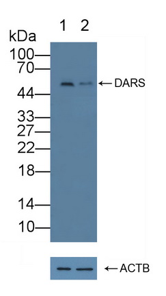 天冬氨酰tRNA合成酶(DARS)多克隆抗体