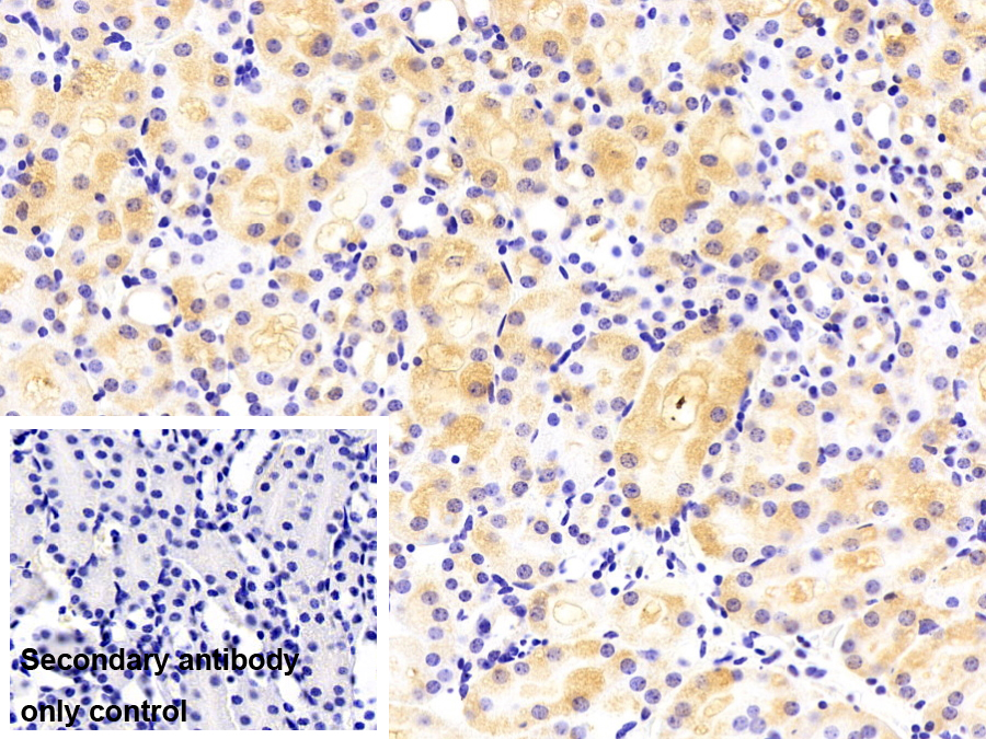 蘇氨酰tRNA合成酶(TARS)多克隆抗體