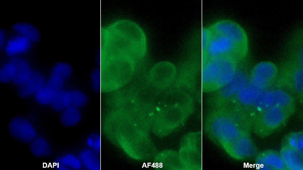70kDa熱休克蛋白8(HSPA8)多克隆抗體
