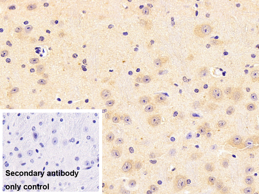 碳酸酐酶Ⅷ(CA8)多克隆抗體