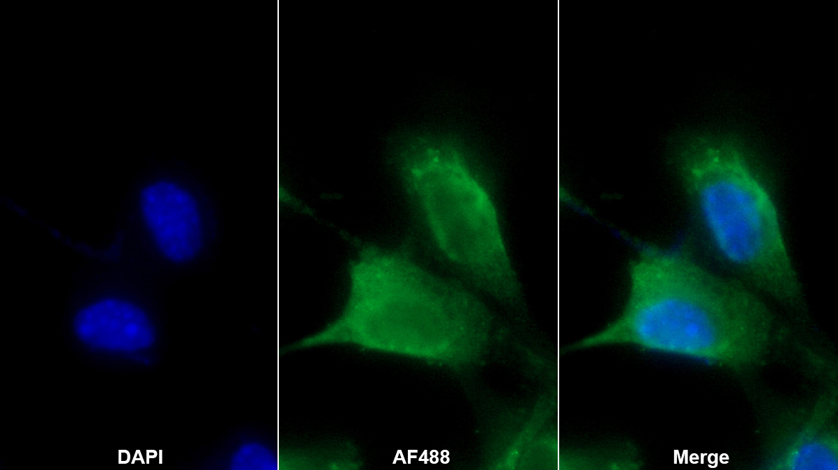 碳酸酐酶ⅤA(CA5A)多克隆抗體
