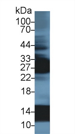 血紅蛋白α1(HBa1)多克隆抗體