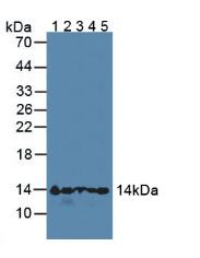 血红蛋白α1(HBa1)多克隆抗体