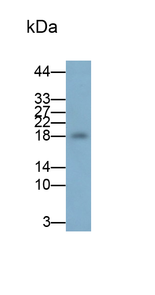 血红蛋白ε1(HBe1)多克隆抗体