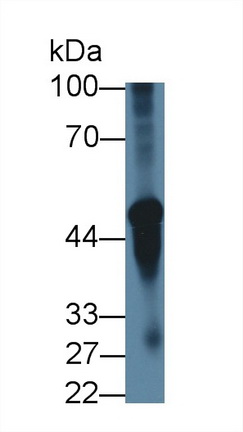 烟碱型胆碱受体α3(CHRNa3)多克隆抗体