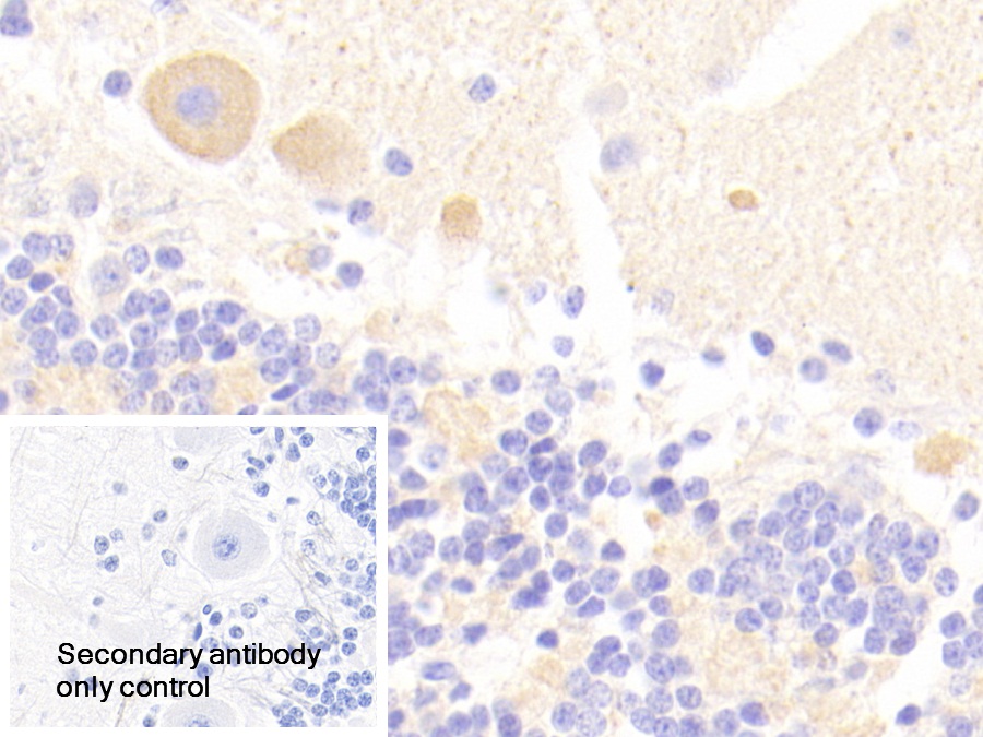 烟碱型胆碱受体α3(CHRNa3)多克隆抗体