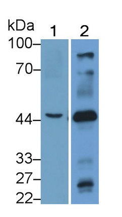 烟碱型胆碱受体β3(CHRNb3)多克隆抗体