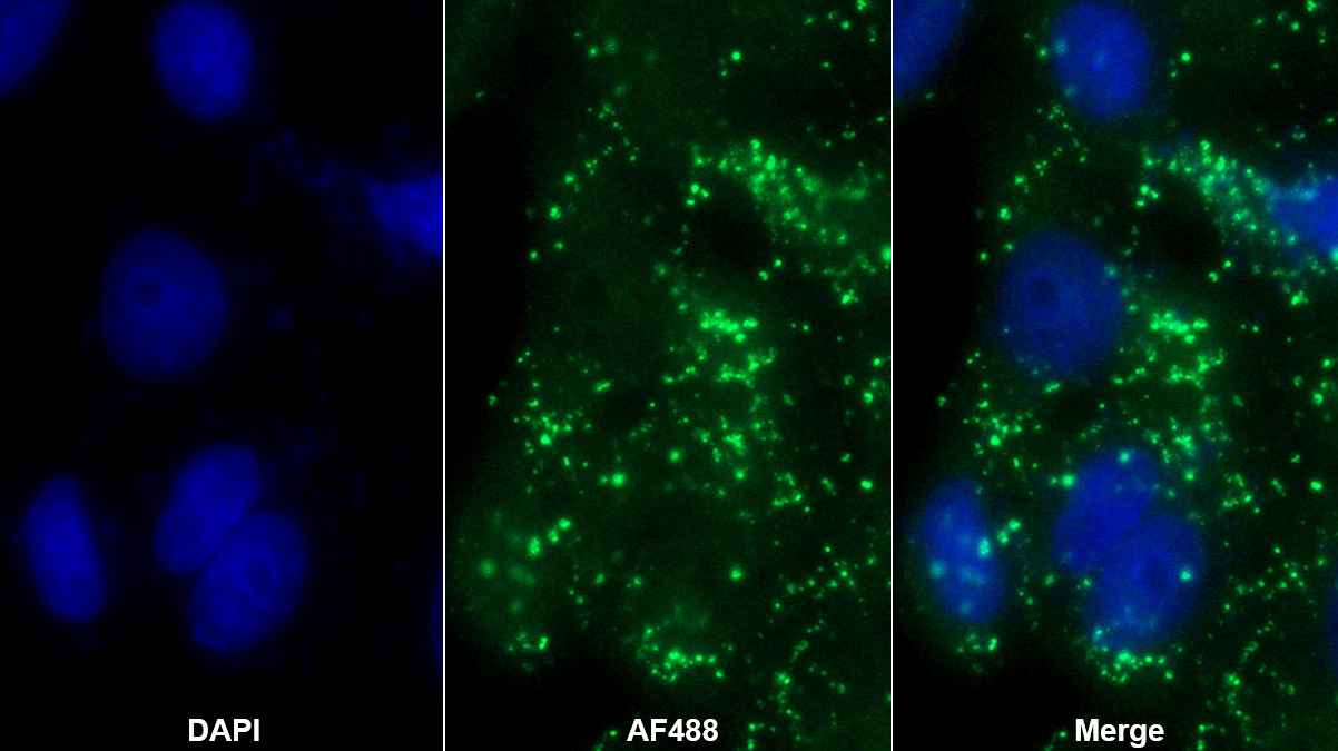 衰老關(guān)鍵蛋白5(FBLN5)多克隆抗體
