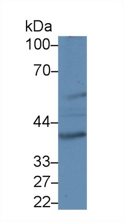 核糖核酸外切酶1(ERI1)多克隆抗体