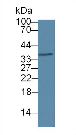 核糖核酸酶H2亚基A(RNASEH2A)多克隆抗体