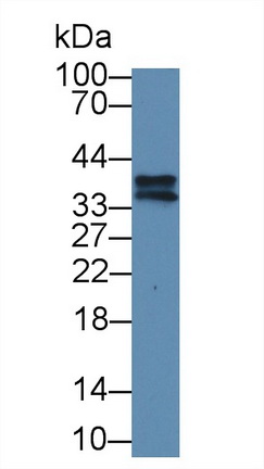 核糖核酸酶H2亚基A(RNASEH2A)多克隆抗体