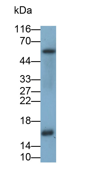 核糖核酸酶A2(RNASE2)多克隆抗体