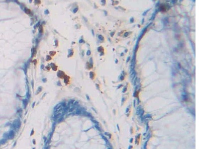 核糖核酸酶A8(RNASE8)多克隆抗体