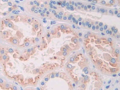 核糖核酸酶A8(RNASE8)多克隆抗体