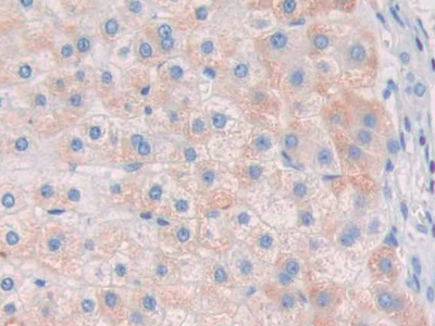 核糖核酸酶A8(RNASE8)多克隆抗体