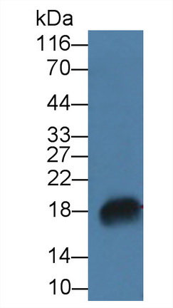 核糖核酸酶A7(RNASE7)多克隆抗体