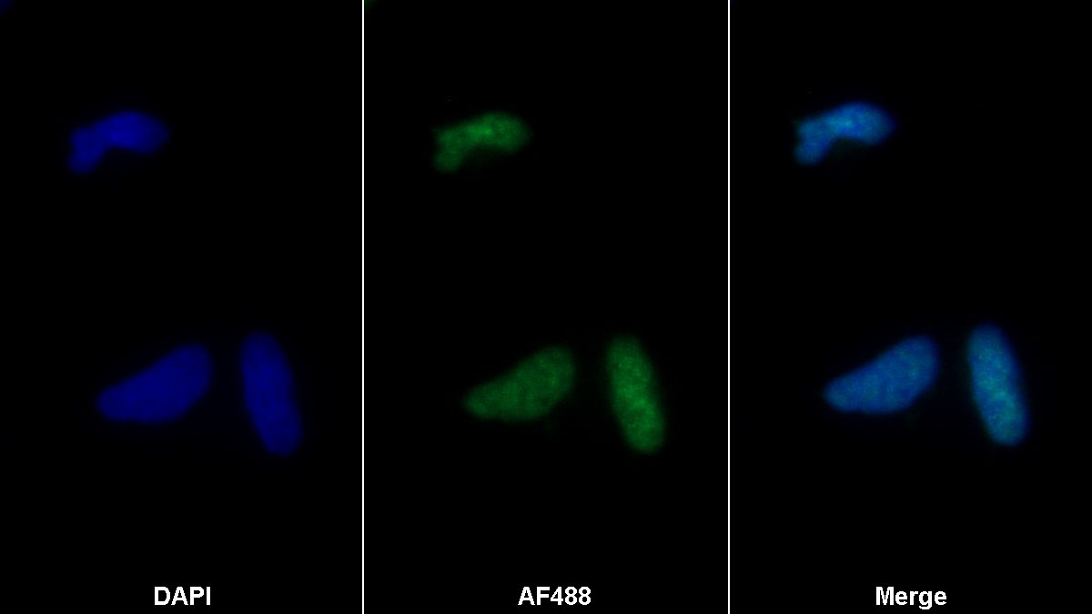 核糖核酸酶A7(RNASE7)多克隆抗体