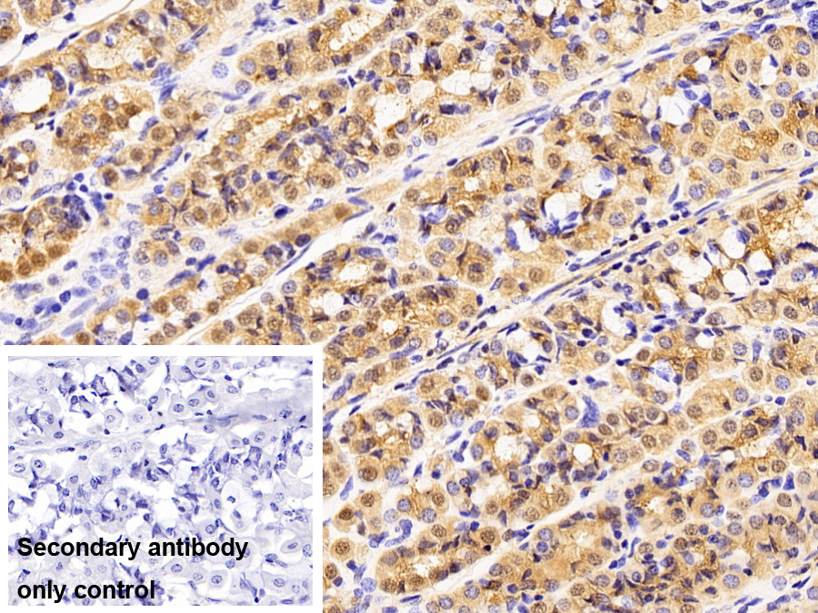 白三烯A4水解酶(LTA4H)多克隆抗體