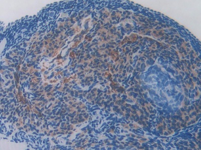 线粒体铁蛋白(FTMT)多克隆抗体