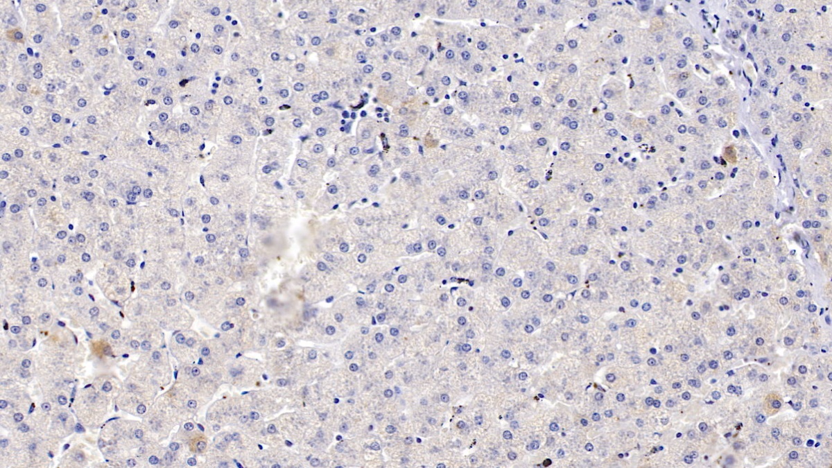 細(xì)胞色素P450家族成員1A2(CYP1A2)多克隆抗體