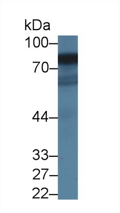 細(xì)胞色素P450氧化還原酶(CPR)多克隆抗體