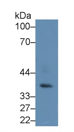 AMP激活蛋白激酶γ1(PRKAg1)多克隆抗体
