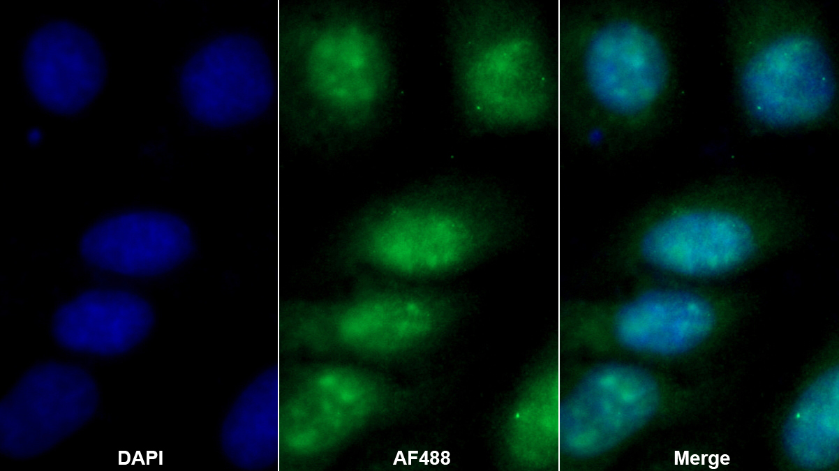 AMP激活蛋白激酶γ1(PRKAg1)多克隆抗體