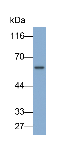 AMP激活蛋白激酶γ2(PRKAg2)多克隆抗體