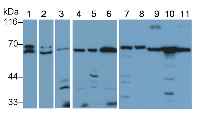 AMP激活蛋白激酶α2(PRKAa2)多克隆抗体