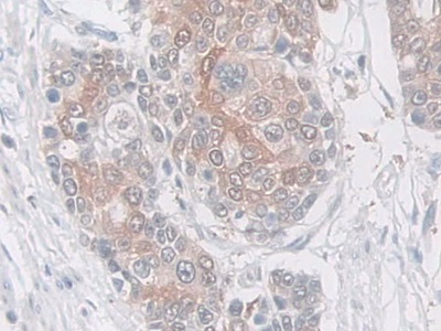 乳腺絲抑蛋白(Maspin)多克隆抗體