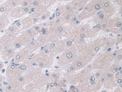 乳腺絲抑蛋白(Maspin)多克隆抗體