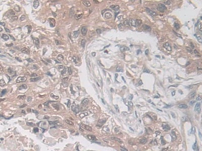 乳腺絲抑蛋白(Maspin)多克隆抗體