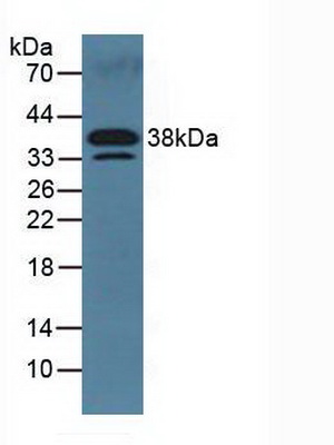 Dickkopf相關(guān)蛋白3(DKK3)多克隆抗體