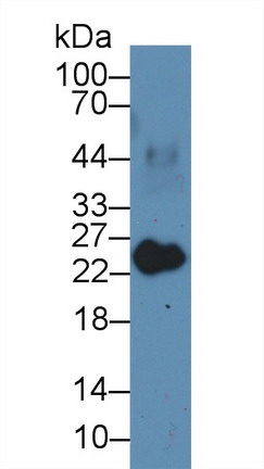 肌球蛋白轻链3(MYL3)多克隆抗体