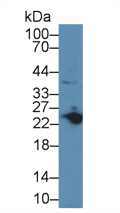 肌球蛋白轻链3(MYL3)多克隆抗体