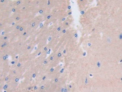 肌球蛋白輕鏈3(MYL3)多克隆抗體