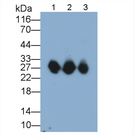 肌球蛋白輕鏈3(MYL3)多克隆抗體